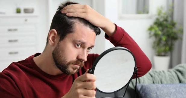 Social media, early hair loss drive young adults towards hair transplants; experts urge caution