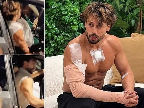 Tiger Shroff firing case: Actor's team shares video of his injured arm, says 'God is kind'